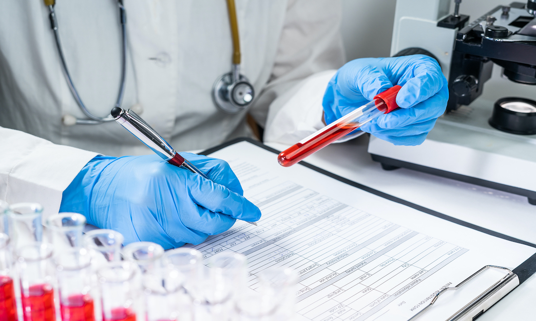 Coronavirus blood test