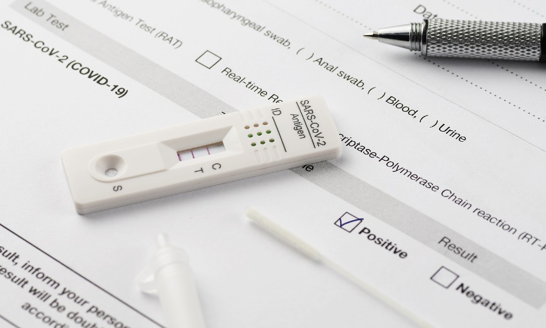 Positive coronavirus test result antigen